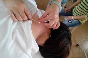 針灸推拿專業 針灸推拿專業