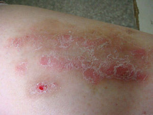 生物細胞斷毒治療體系 生物細胞斷毒治療體系