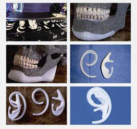 一次性支架造耳 一次性支架造耳