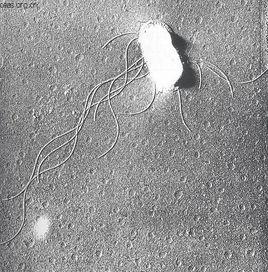 傷寒桿菌 傷寒桿菌