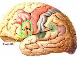 言語功能的部分喪失 言語功能的部分喪失