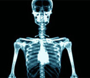 X光掃瞄器 X光掃瞄器