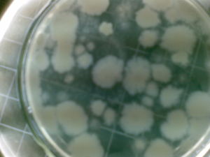 糞大腸菌群 糞大腸菌群