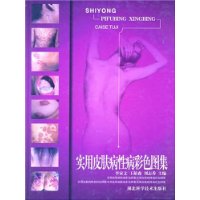 皮膚病彩色圖