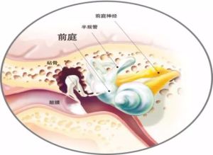 前庭功能紊亂 前庭功能紊亂