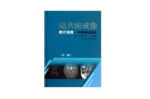 磁共振成像讀片指南:中樞神經系統 磁共振成像讀片指南:中樞神經系統