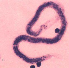馬來布魯線蟲 馬來布魯線蟲