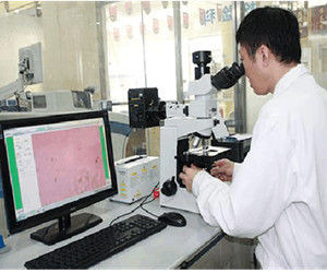 精液脫落細胞學檢測技術 精液脫落細胞學檢測技術