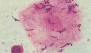 紅球菌屬 紅球菌屬