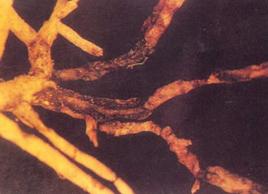 牡丹根腐病 牡丹根腐病