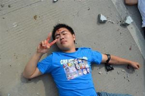 淡定的受傷人員