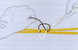 新手術用線 新手術用線