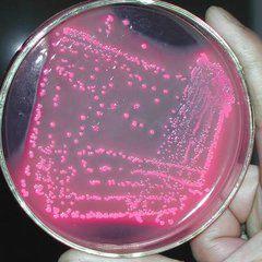 拉氧頭孢鈉注射液 拉氧頭孢鈉注射液