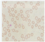 紅細胞平均血紅蛋白濃度