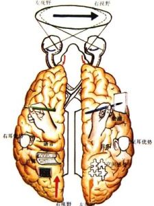 大腦半球 大腦半球