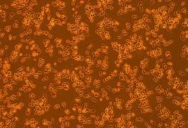 纖維細胞 纖維細胞