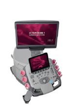 智慧型彩色都卜勒超聲診斷系統