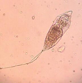 暗小異尾輪蟲 暗小異尾輪蟲