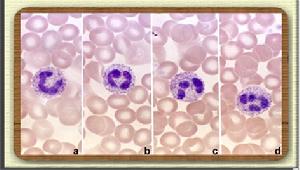 （圖）中性粒細胞
