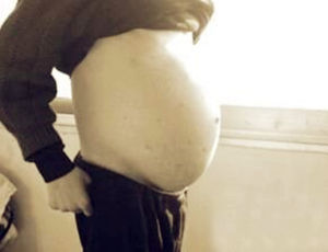 腹部腫瘤 腹部腫瘤