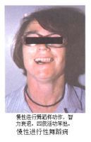 亨汀頓氏舞蹈症 