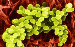 葡萄球菌性食物中毒 葡萄球菌性食物中毒