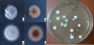 吸水鏈黴菌敏感變種 吸水鏈黴菌敏感變種