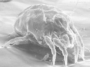 顯微鏡下的蟎蟲