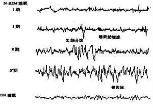 相關年齡睡眠期的分布