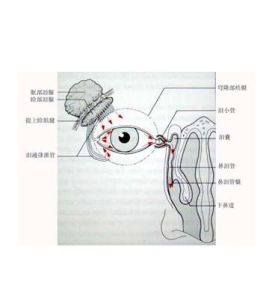 慢性淚囊炎 慢性淚囊炎
