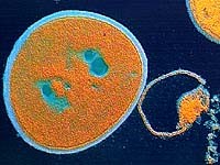 超級細菌MRSA