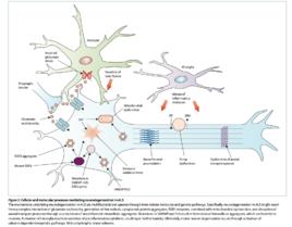 神經退行性疾病 神經退行性疾病