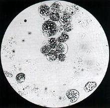 前列腺顆粒細胞