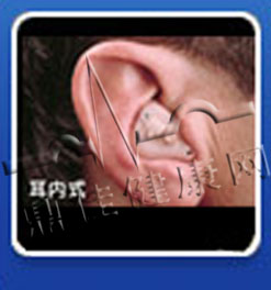 耳毒性耳聾