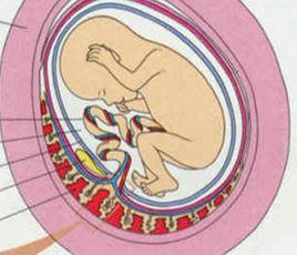 人工胎盤剝離術 人工胎盤剝離術