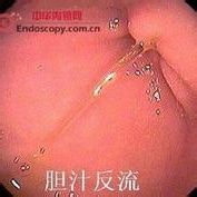 腸液 腸液