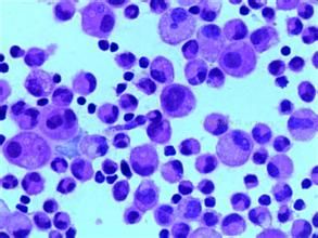 脫落細胞學 脫落細胞學