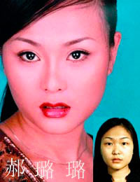 整形依賴症 整形依賴症