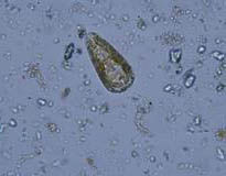 窄雙菱藻 窄雙菱藻