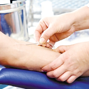 副腫瘤性斜視性眼肌陣攣-肌陣攣