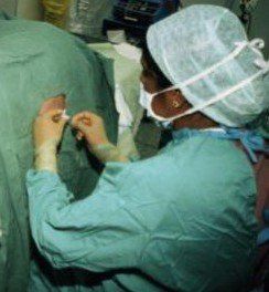 全身麻醉 全身麻醉