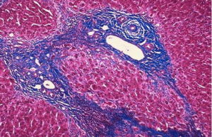 自由基抑制劑 自由基抑制劑