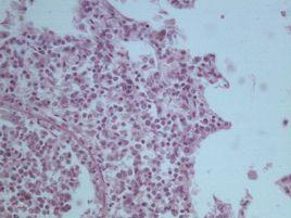 檸檬酸細菌屬 檸檬酸細菌屬