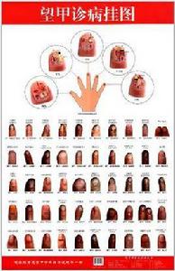 望甲診病掛圖 望甲診病掛圖