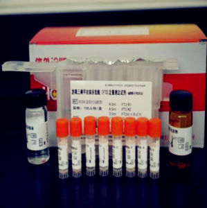 游離三碘甲狀腺原氨酸 游離三碘甲狀腺原氨酸