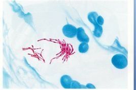 分枝桿菌 分枝桿菌