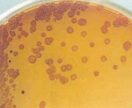 假單胞菌屬 假單胞菌屬