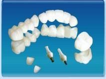 牙齒修復 牙齒修復