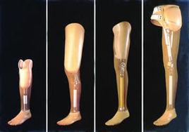 髖離斷假肢 髖離斷假肢