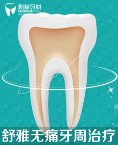 舒雅無痛牙周治療 舒雅無痛牙周治療